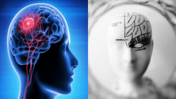 World Brain Day: Patients' brain is recovering rapidly in home environment