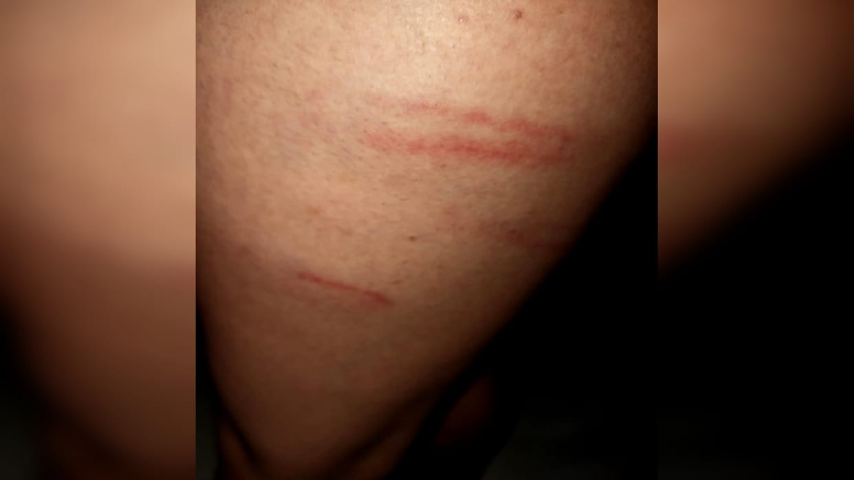 Teacher beats class four student in Greater Noida for growing hair