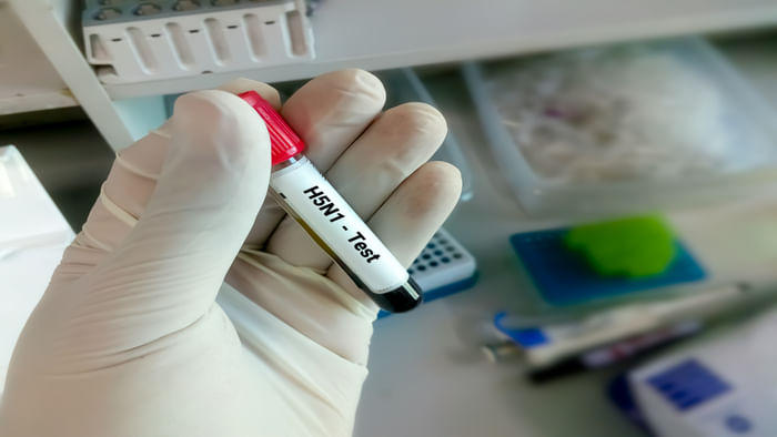 avian influenza H5N1 outbreak in  Uttarakhand latest news and updates why bird flu is dangerous