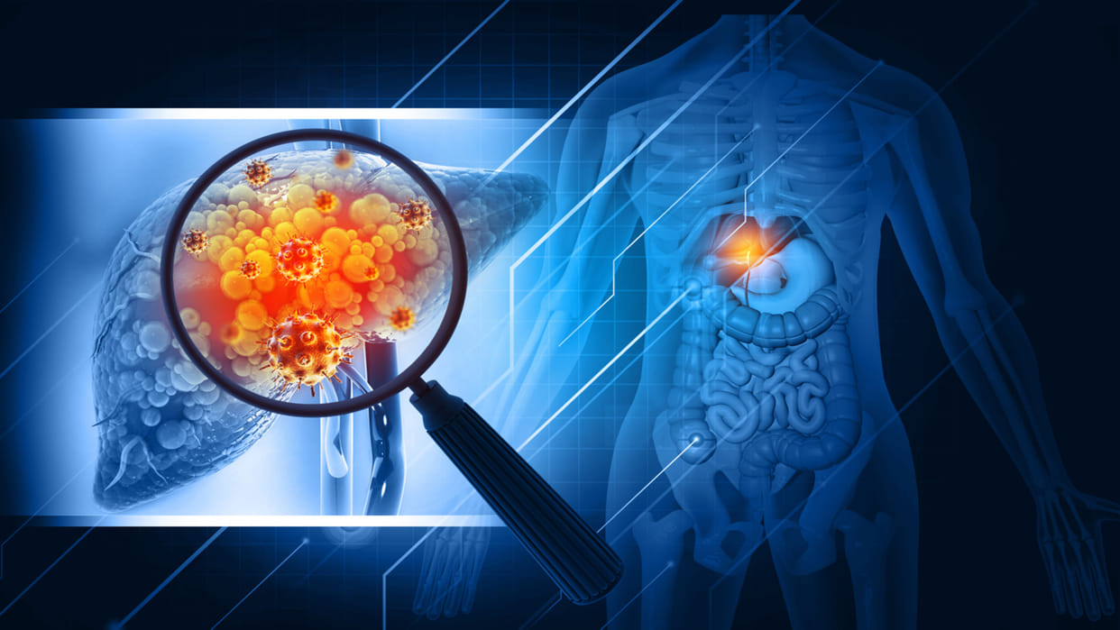 US: Pfizer agrees to settlement on 10 thousand claims of Zintac causing cancer