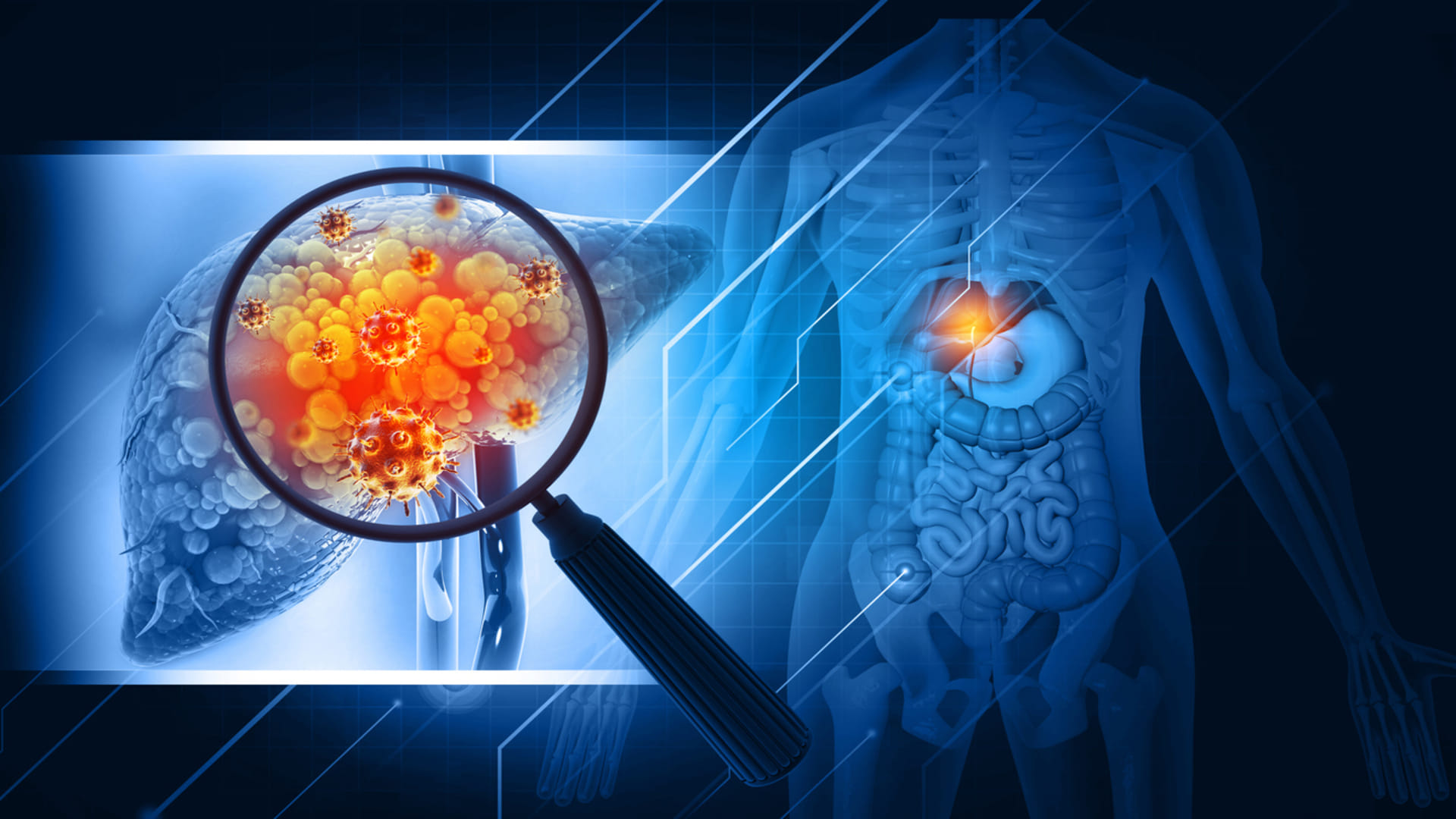 leading causes of death in India non communicable diseases in india