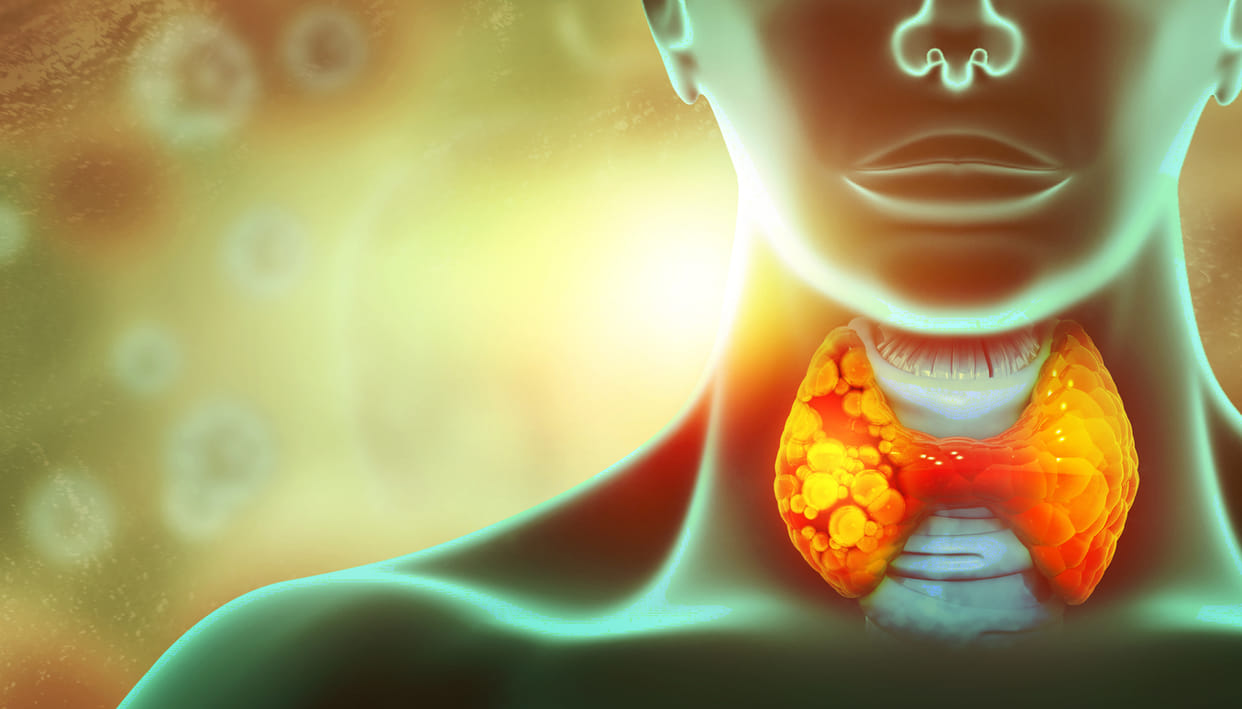 According to WHO Bad lifestyle is main reason for thyroid, do not ignore it, it can be fatal