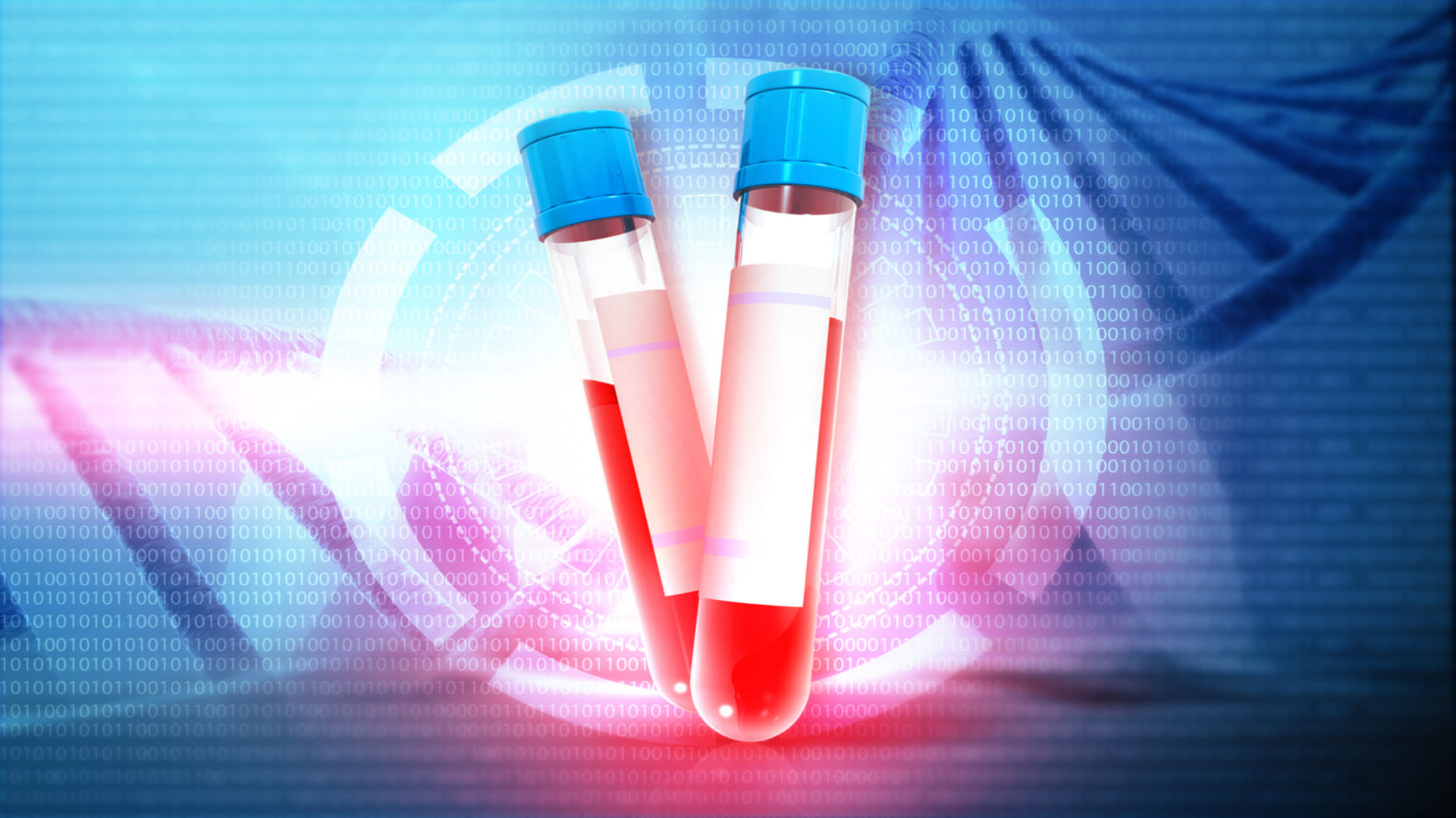 triglycerides cause heart attack What Foods and Drinks increase its risk