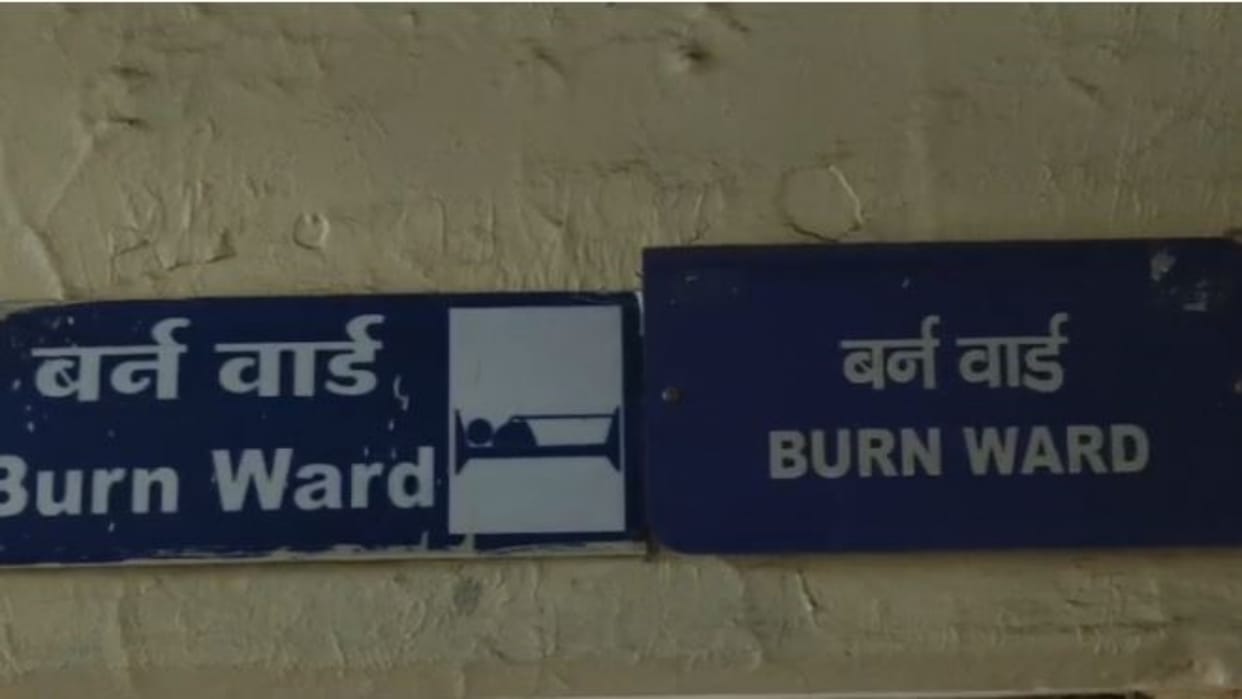 Alwar News: 2 year old innocent seriously injured after spilling hot tea, undergoing treatment in hospital