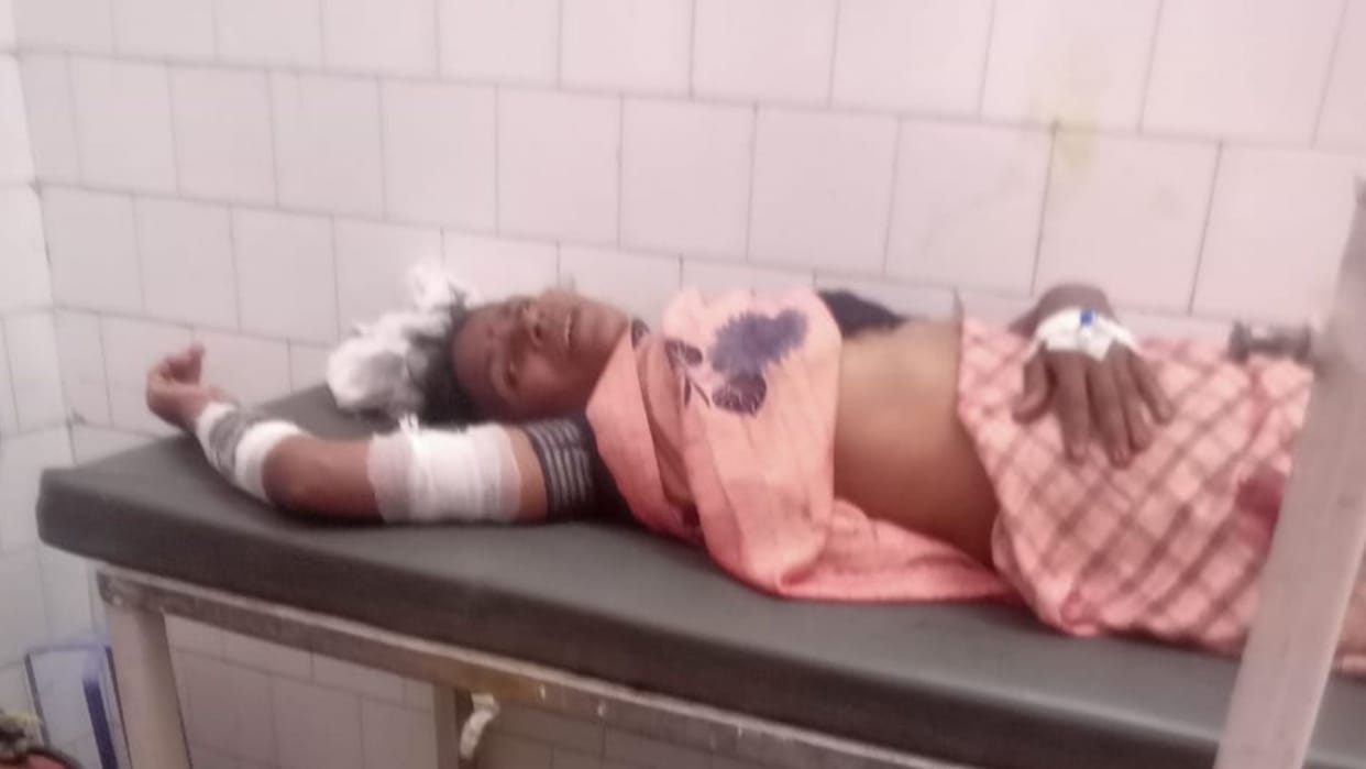 rebar entered woman hand after falling into pit during drain construction in chandauli