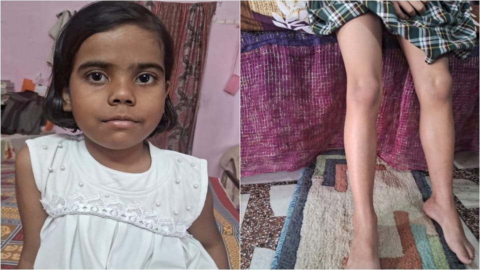 radiator of the school van burst four girl students got burnt due to boiling coolant passersby helped