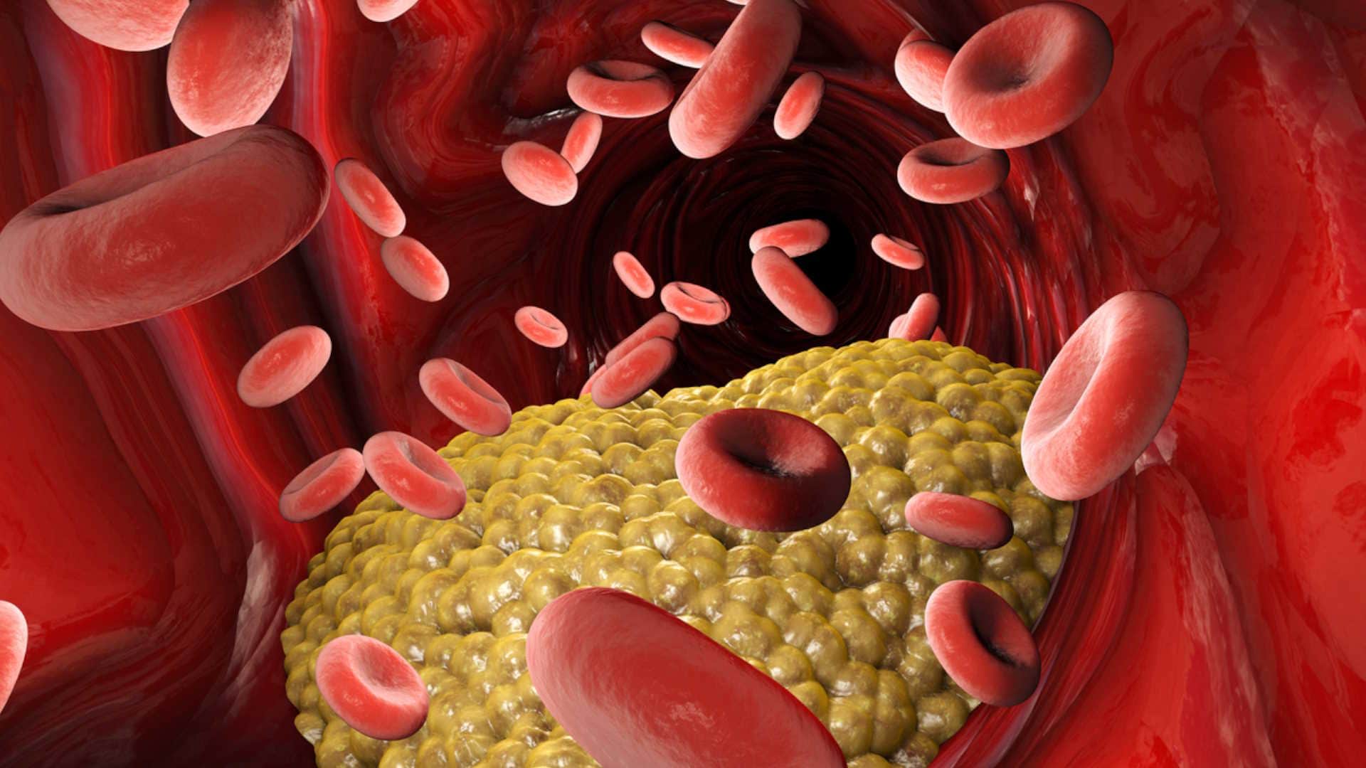 How To Reduce High Cholesterol Know Tips For Improving Heart Health Naturally
