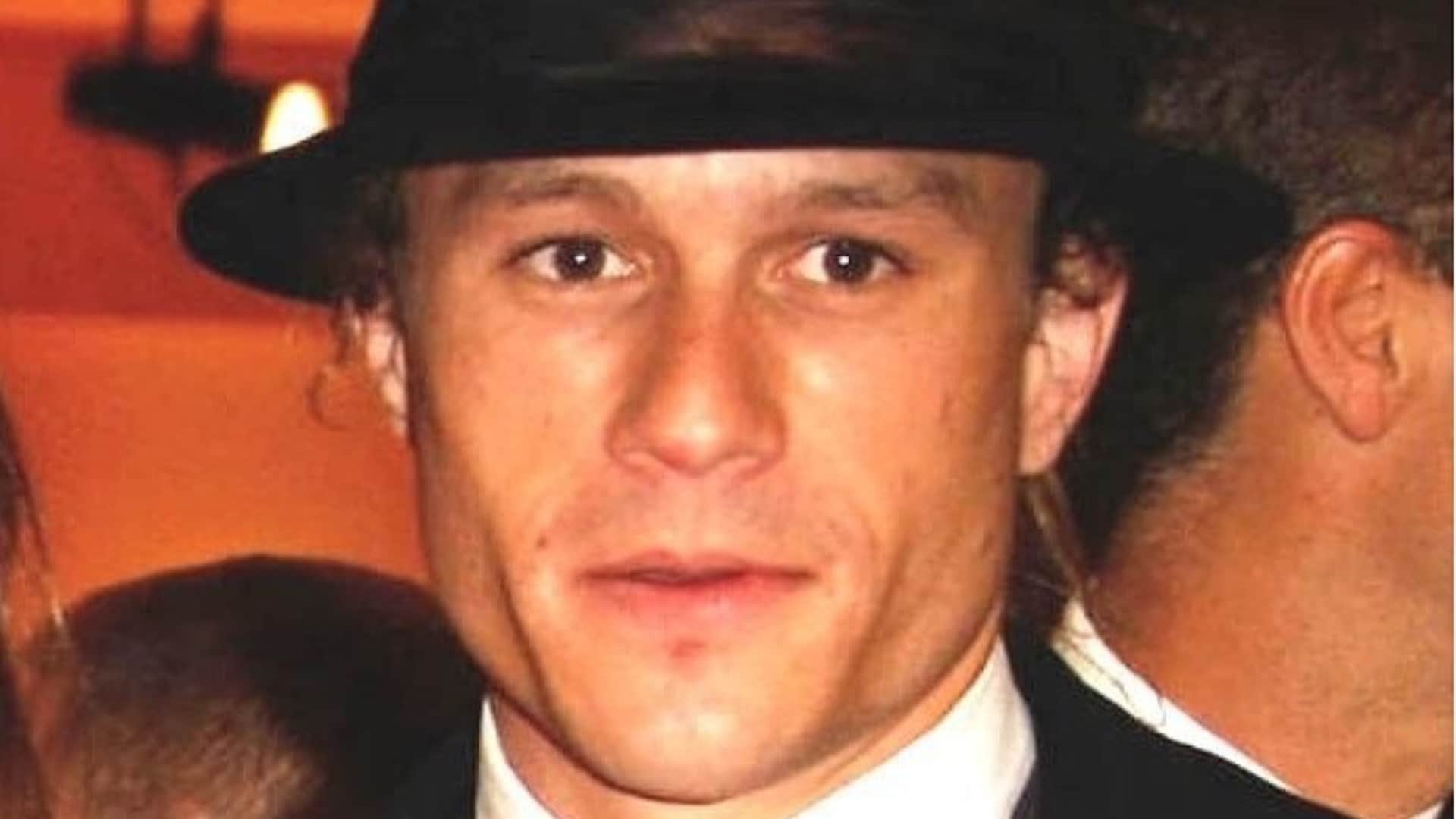 Actors Who Needed Treatment After Playing Important Role of Their Career Ranveer Singh