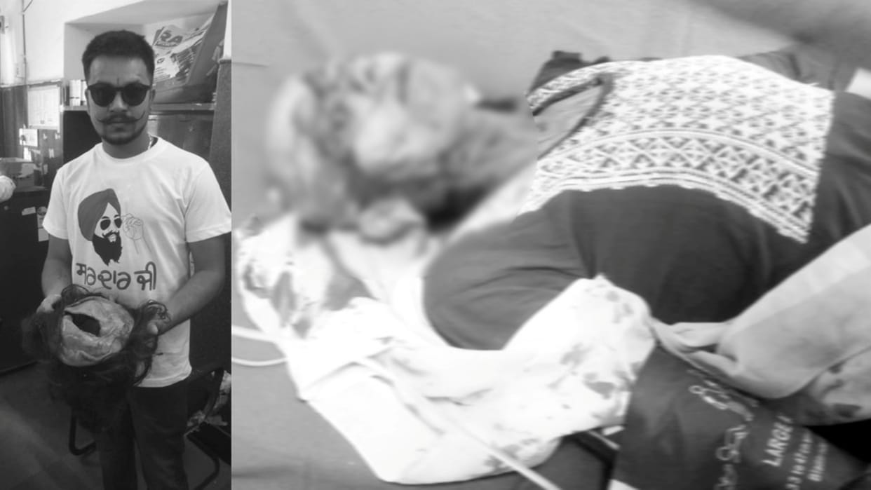 Udaipur News: Girl's hair uprooted along with skin after getting stuck in sugarcane juice extraction machine