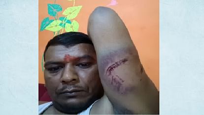 Moradabad: Public troubled by terror of mad horse, young man bitten and injured