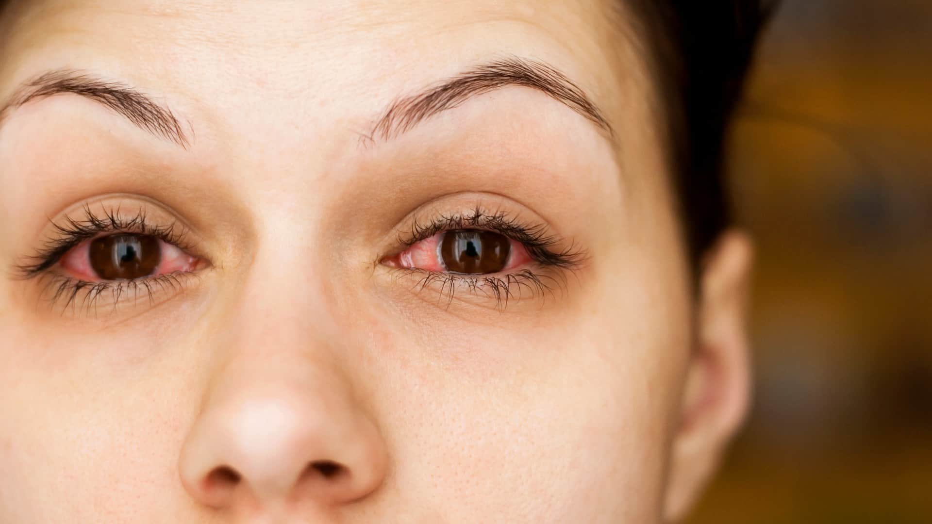 side effect of Fake Eye lashes in hindi