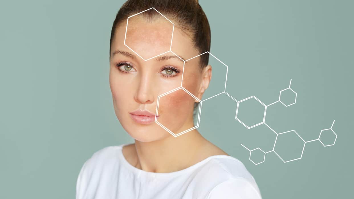 Sunburn Home Remedies In hindi effective tips to get rid of sunburn