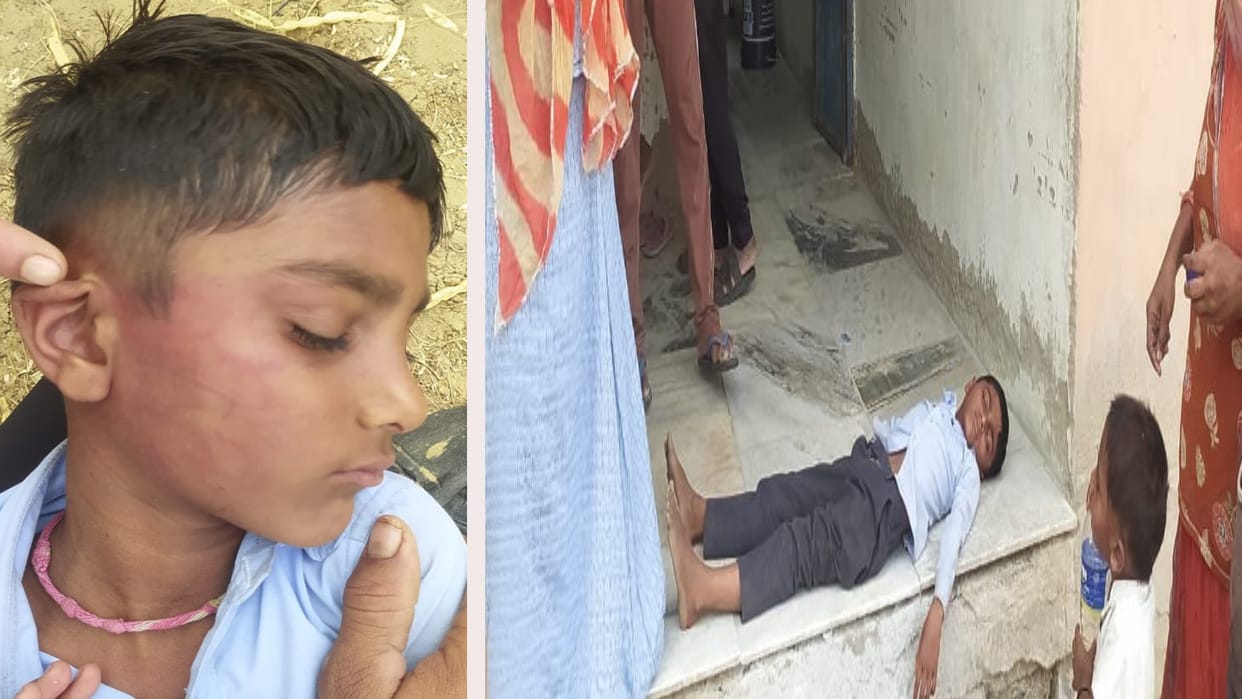 Rajasthan News: Student brutally beaten for writing wrong roll number, accused teacher immediately suspended