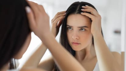 Mystery virus causes sudden hair loss infection know baldness virus Symptoms and Details in Hindi