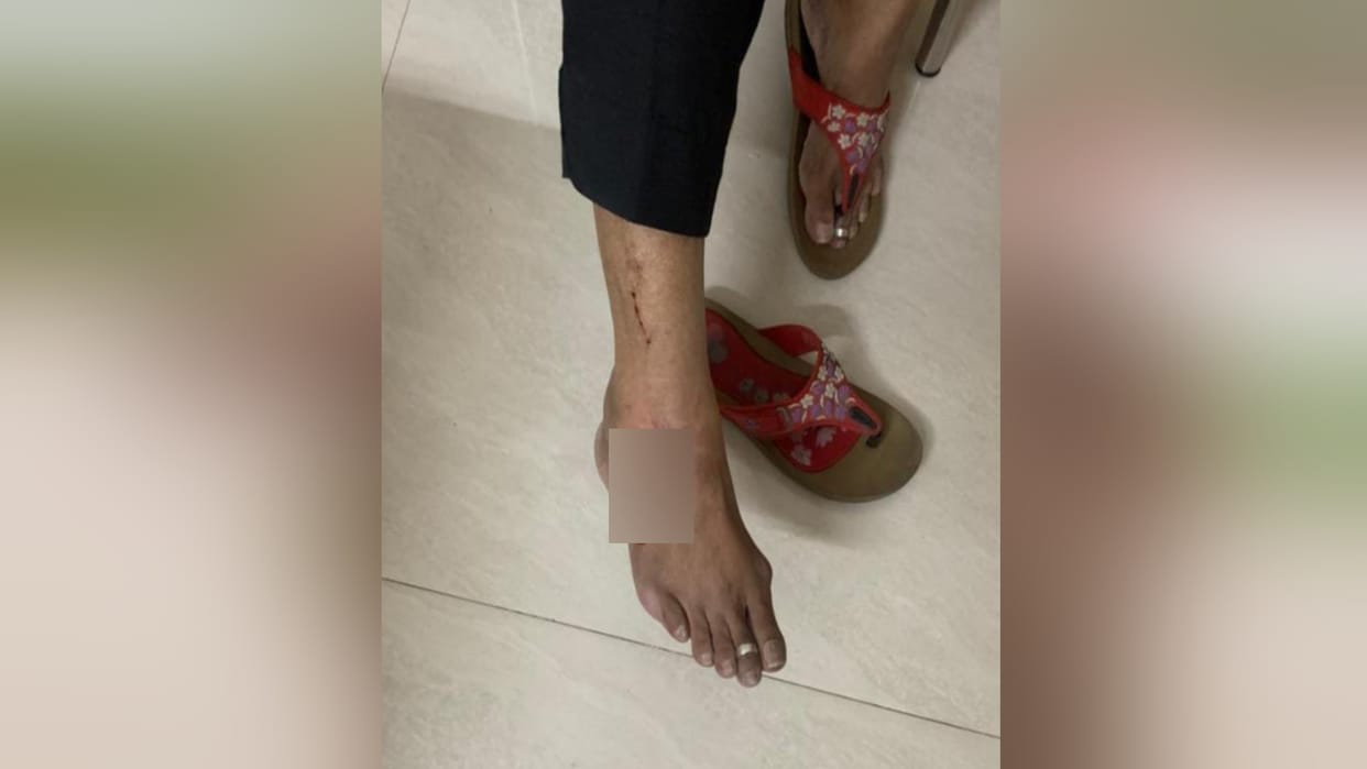 Monkeys attack a woman in Prabhatnagar of Meerut and people are in panic