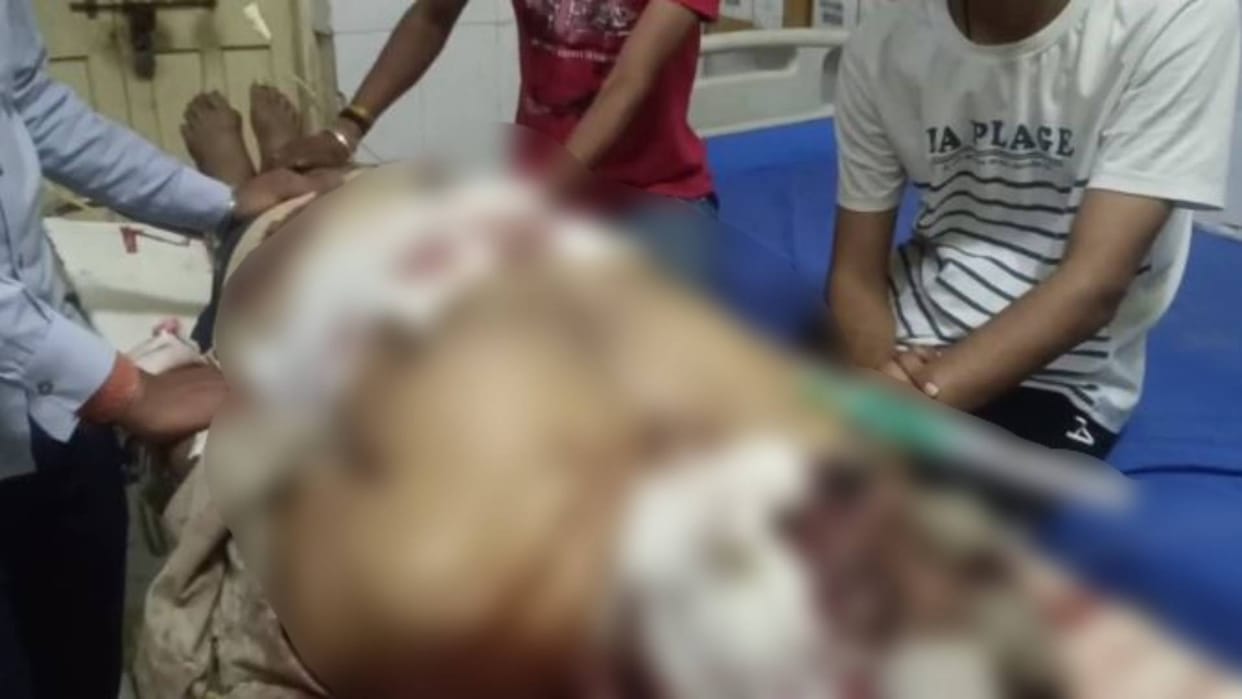 Baran Bank guard got shot due to sudden trigger pull seriously injured Bhanwar Singh critical condition
