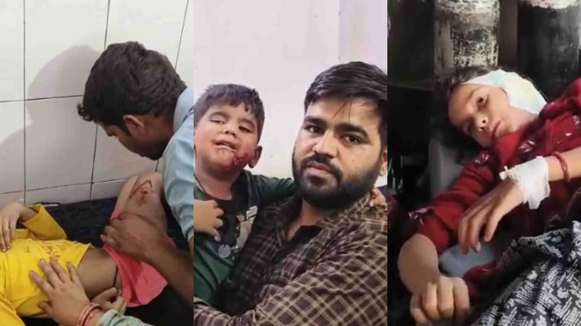 अस्पताल लाए गए कुत्ते के हमले घायल बच्चे।
