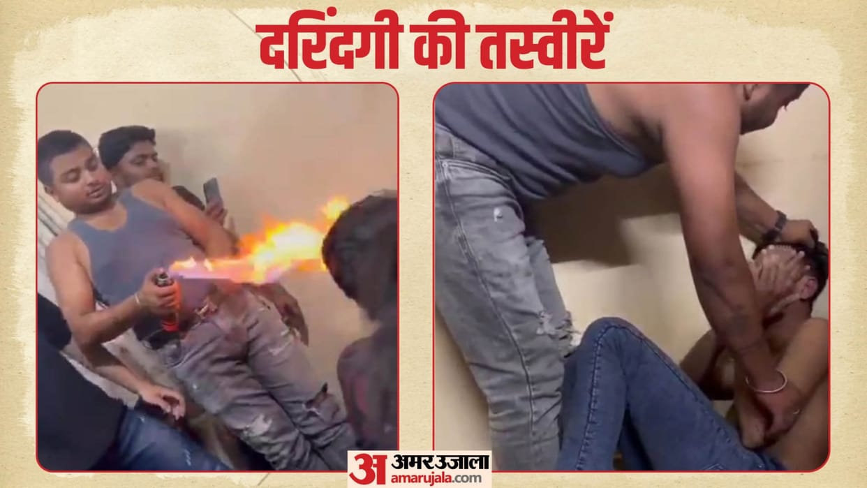 Friends held students hostage and beaten or burn him then tied brick to his private parts In Kanpur see photos
