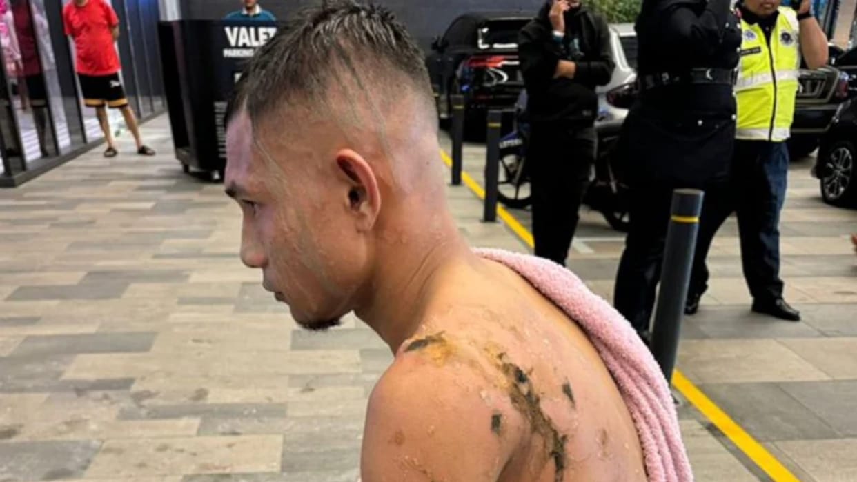 Malaysia Football Star Faisal Halim Suffers Acid Attack 3 Days After Assault On Teammate