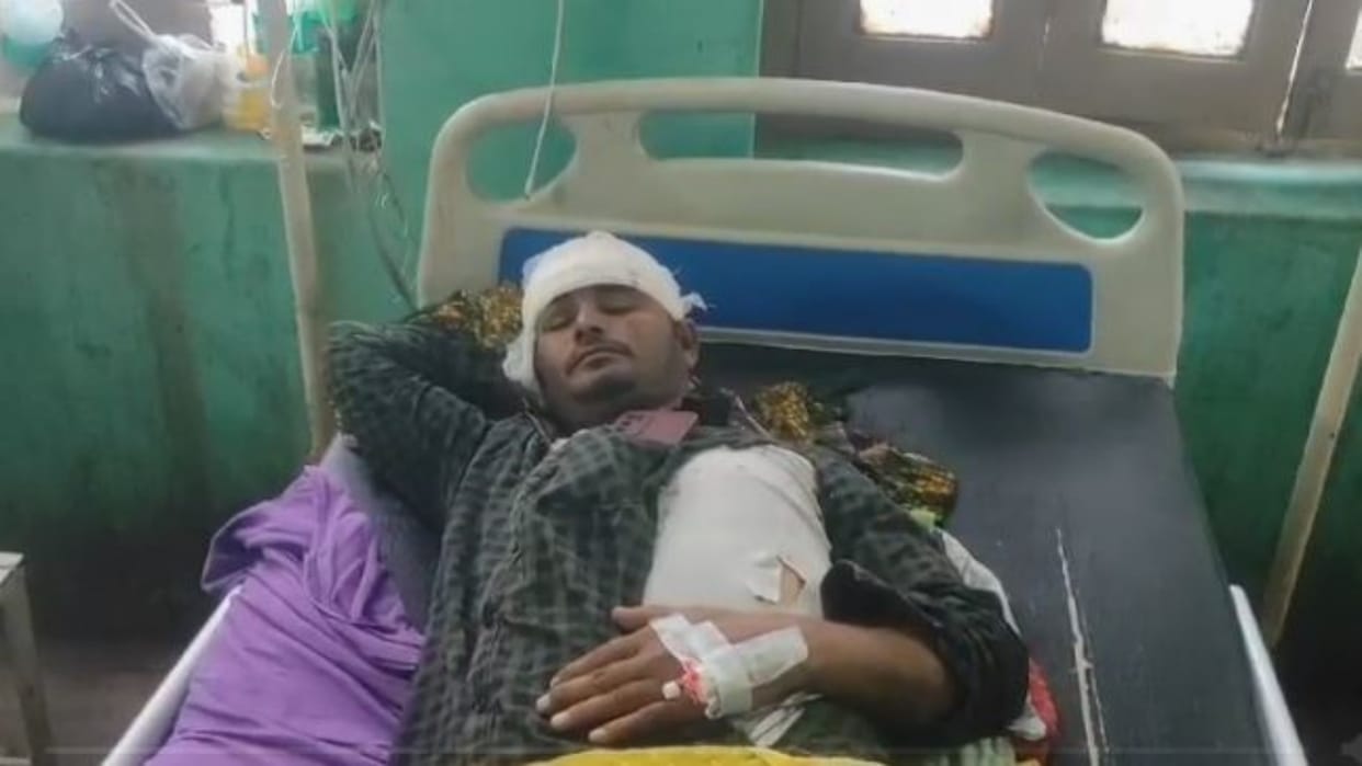 Alwar News: Uncle breaks nephew's head in dispute over boring, treatment underway in district hospital