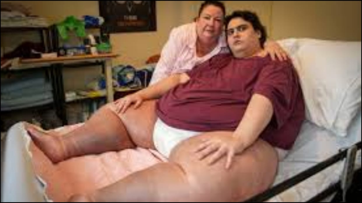 UKs Heaviest Man Dies From Organ Failure Days Before his Birthday news in hindi