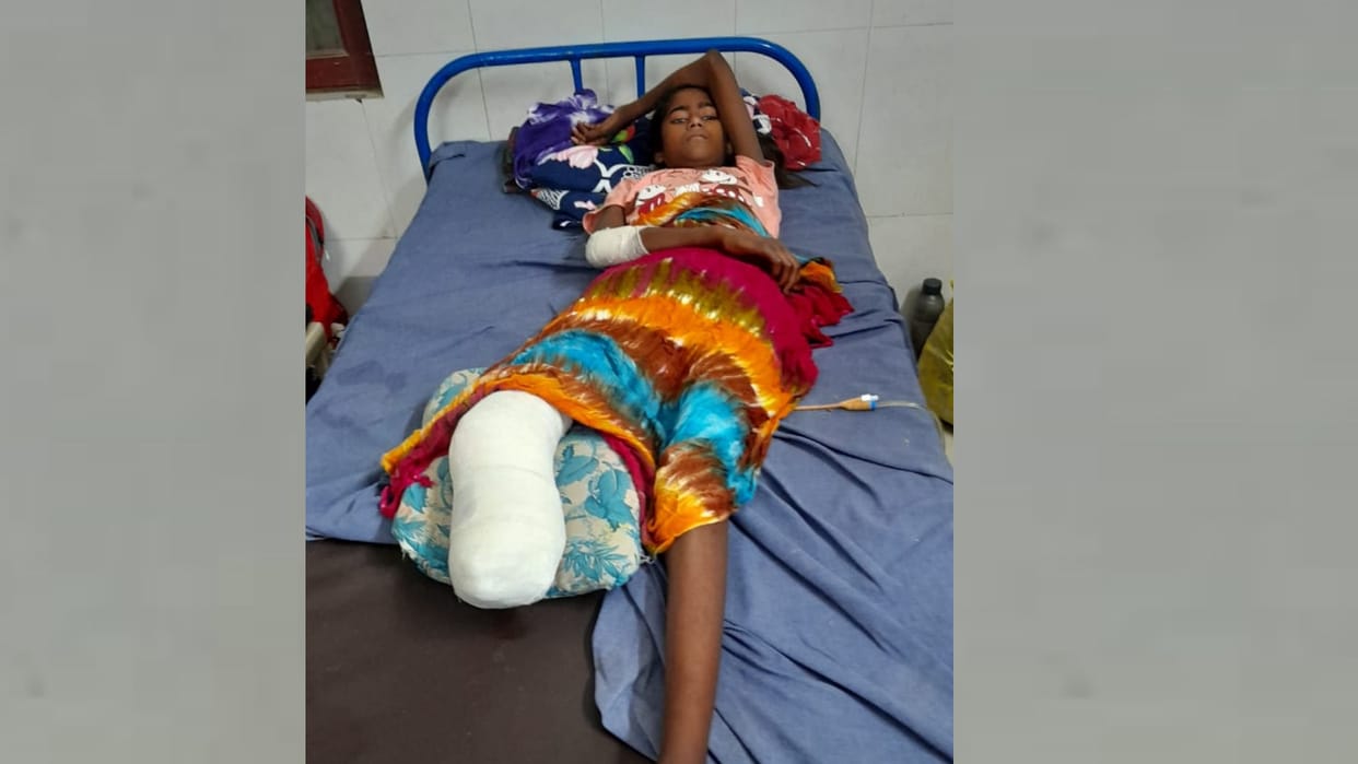 A small girl's leg was cut because of carelessness of hospital in Mohanlalganj.