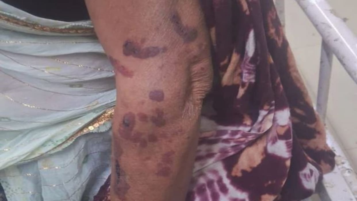 Shameful act: A tribal woman was beaten and her clothes torn, police registered a case against eight attackers