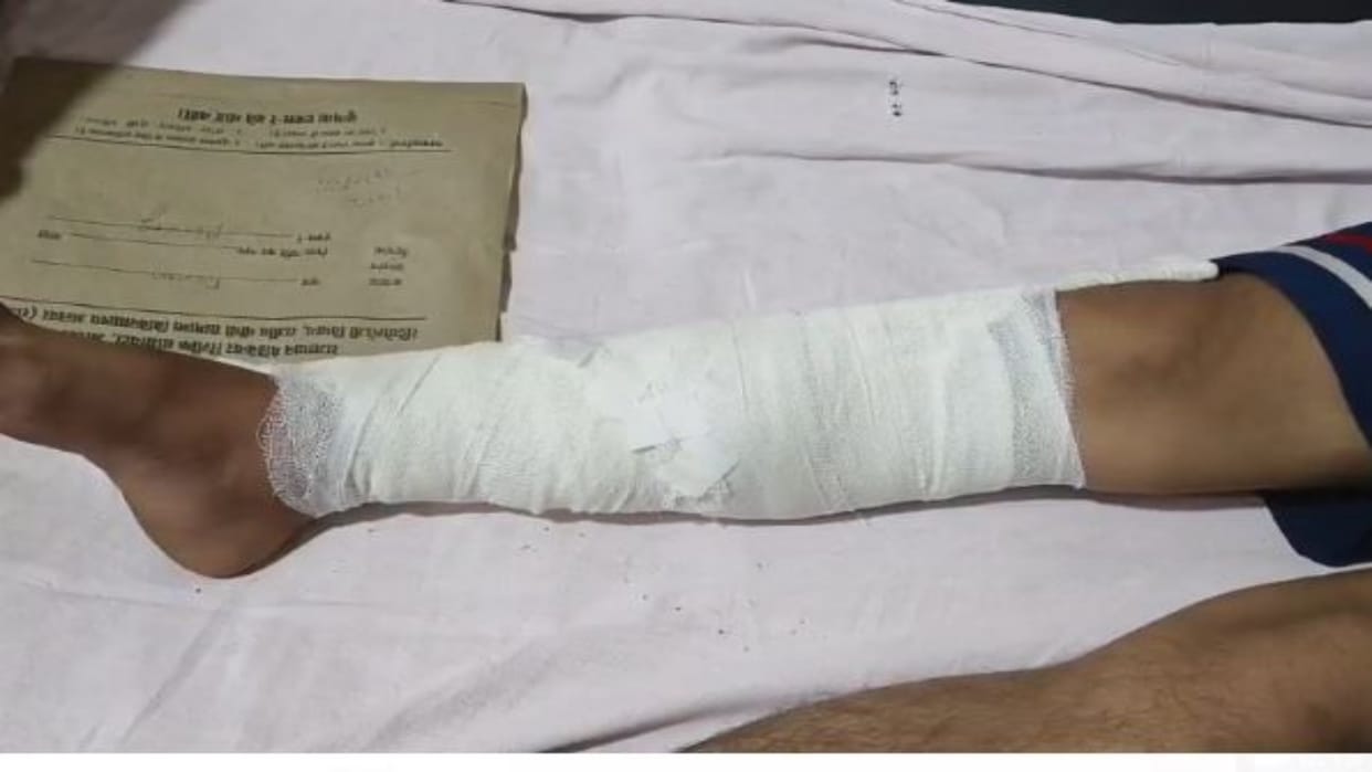 Alwar News: Dispute over parking bike on the road reached level of fight, one injured by hitting with a stick