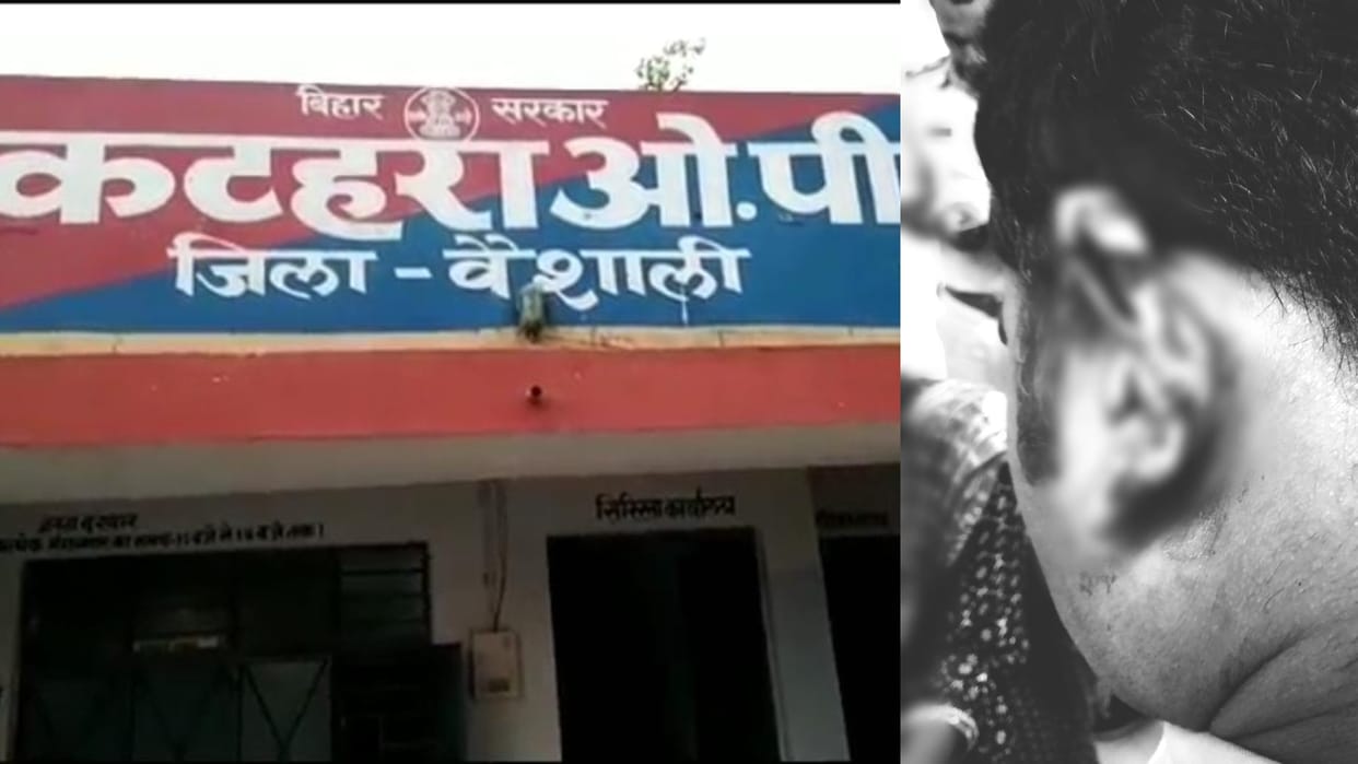 Bihar News : Attack on Bihar police team in vaishali went to arrest robbery accused, SHO ears cut off