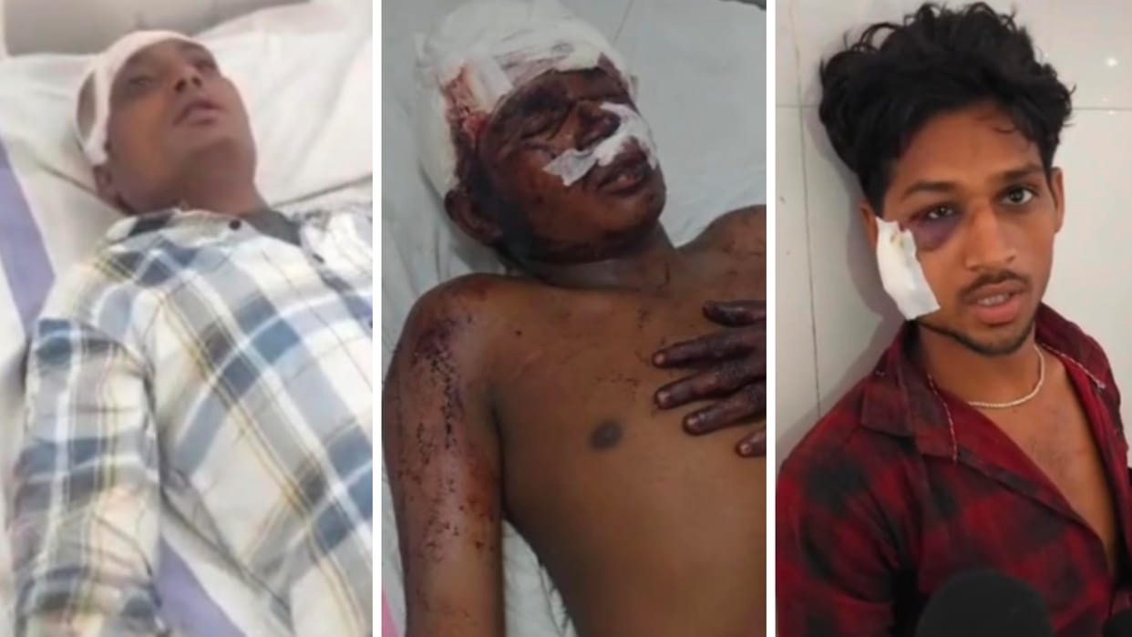 Ujjain: Bolero collided with artisans coming to carve stones in Mahakal temple, eight people injured