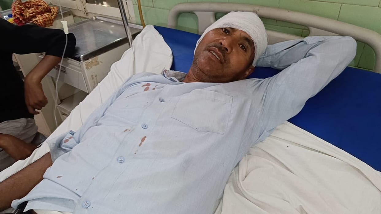 Monkey bites passenger ear at Izzatnagar railway station in Bareilly
