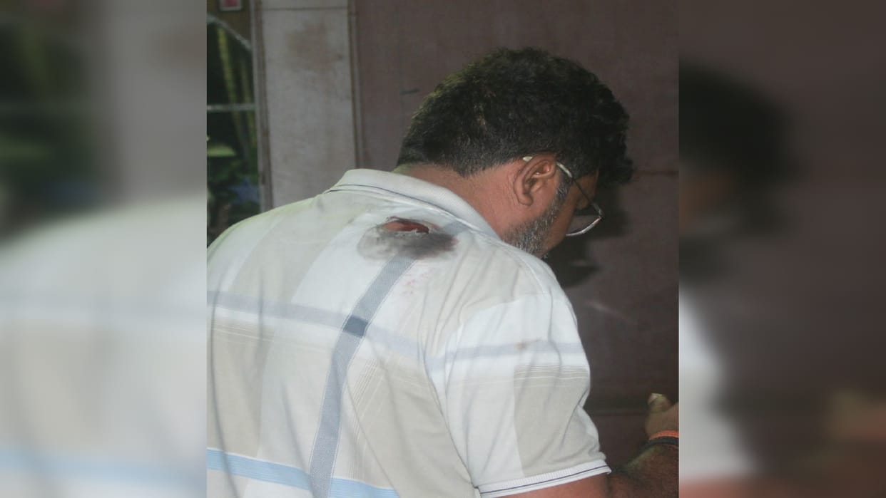 Murder accused shot due to rivalry in Moradabad
