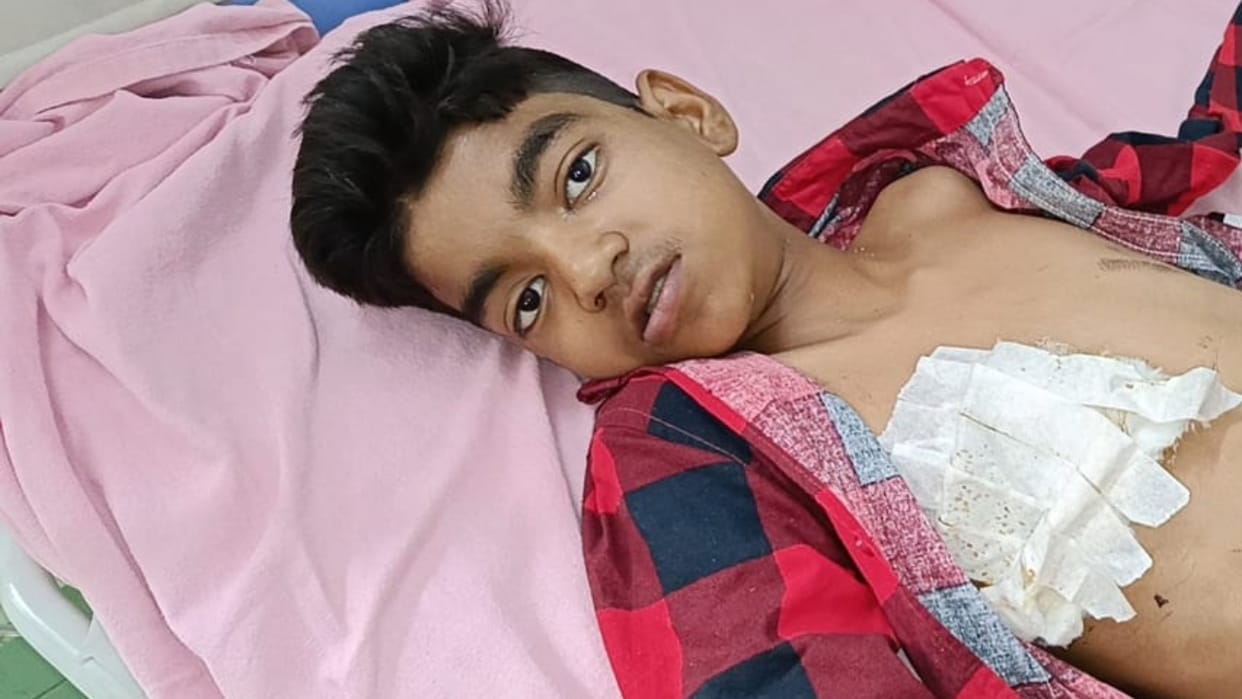 wild pig attacked 12 year old boy who was going to the farm in Bareilly