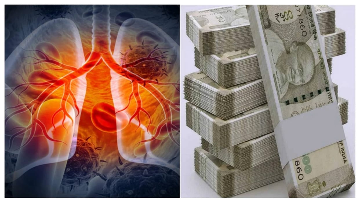 Treatment expenses for diseases caused by gutka and tobacco will increase in India