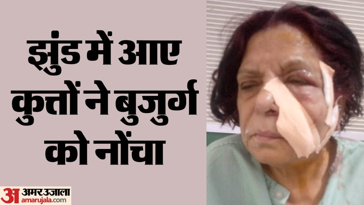 dogs attacked a 75-year-old woman in Sevi Villa De Rajnagar Extension 28 stitches on her face