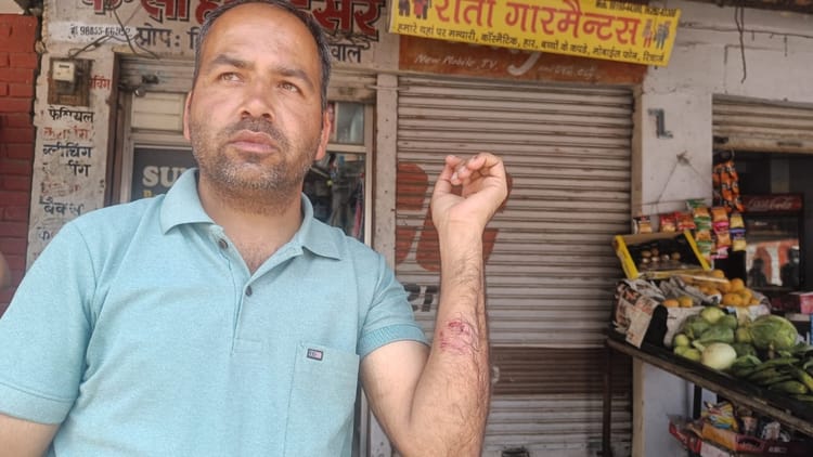 Bilaspur: Five People Including Four Children Were Bitten By An