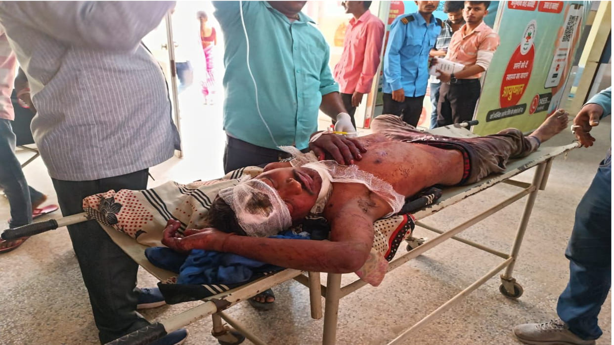 In Maharajganj, younger brother attacked elder brother with a knife and injured him.