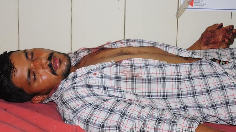 Amroha: बीएससी के छात्र को मारी गोली.. तमंचे की बट से भी पीटा, अस्पताल में किया गया भर्ती, पुलिस जांच जारी