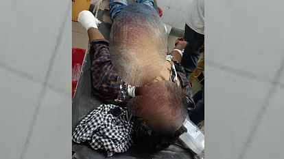 Bahraich: बहराइच में उर्स के दौरान गोला फटने से नौ लोग घायल, तीन की हालत गंभीर Nine injured during firework on Urs in Bahraich.