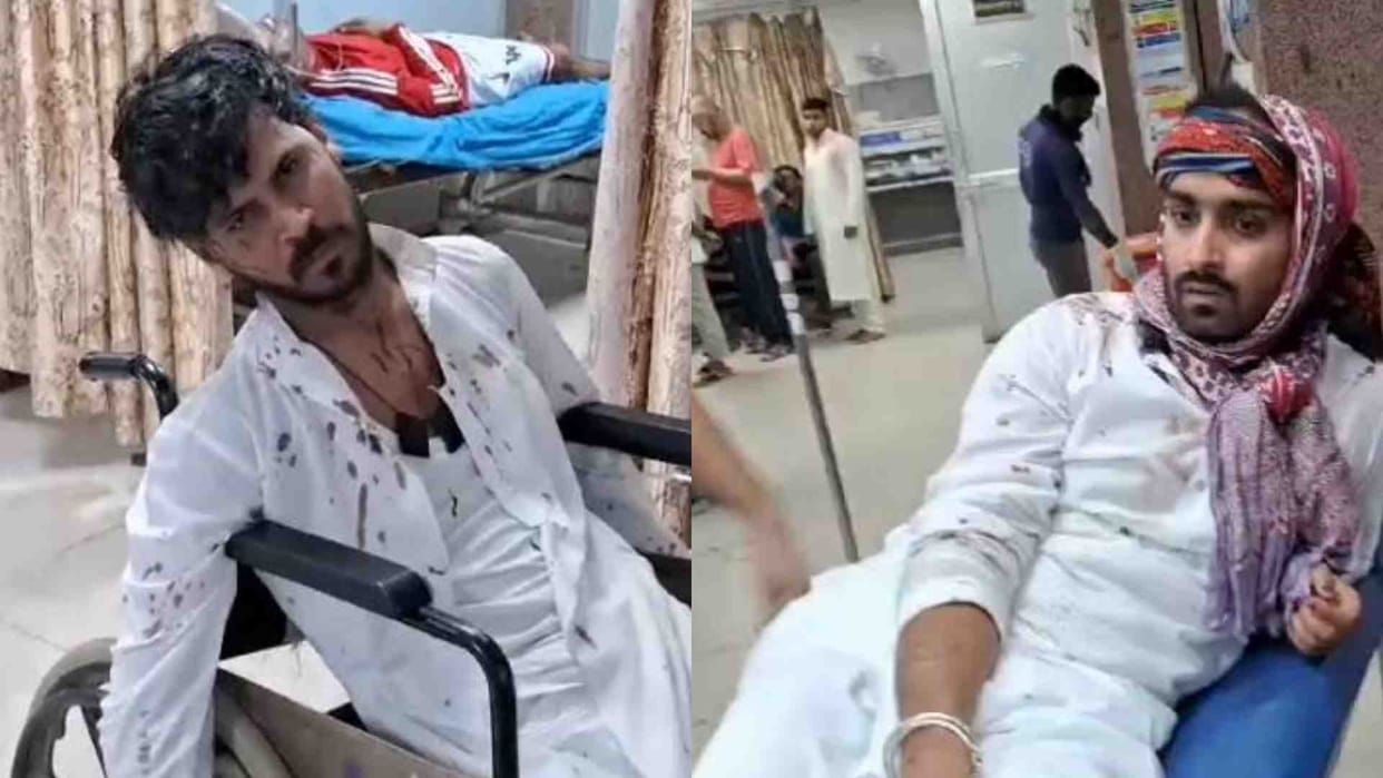 Ajmer News: Dargah servants attacked each other with swords