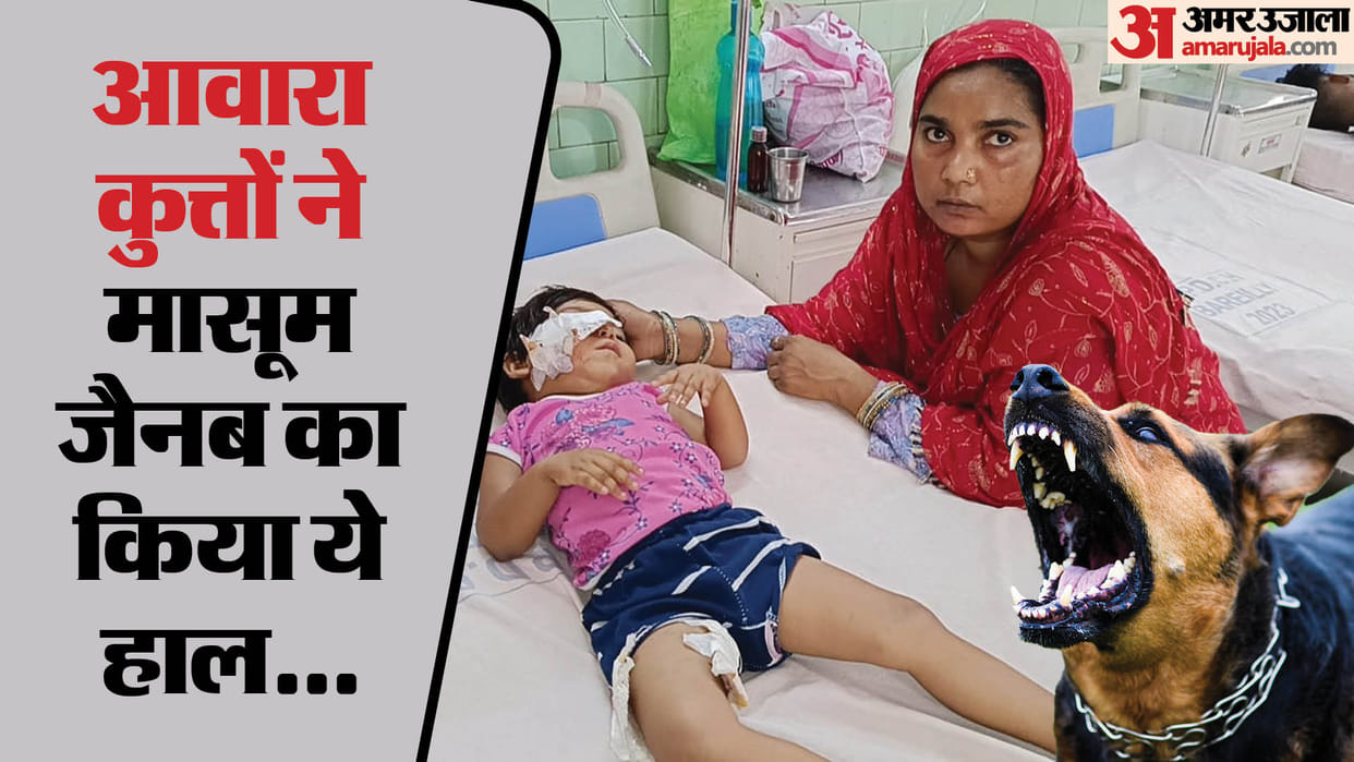 Street Dogs Attacked Three Year Old Girl In Bareilly