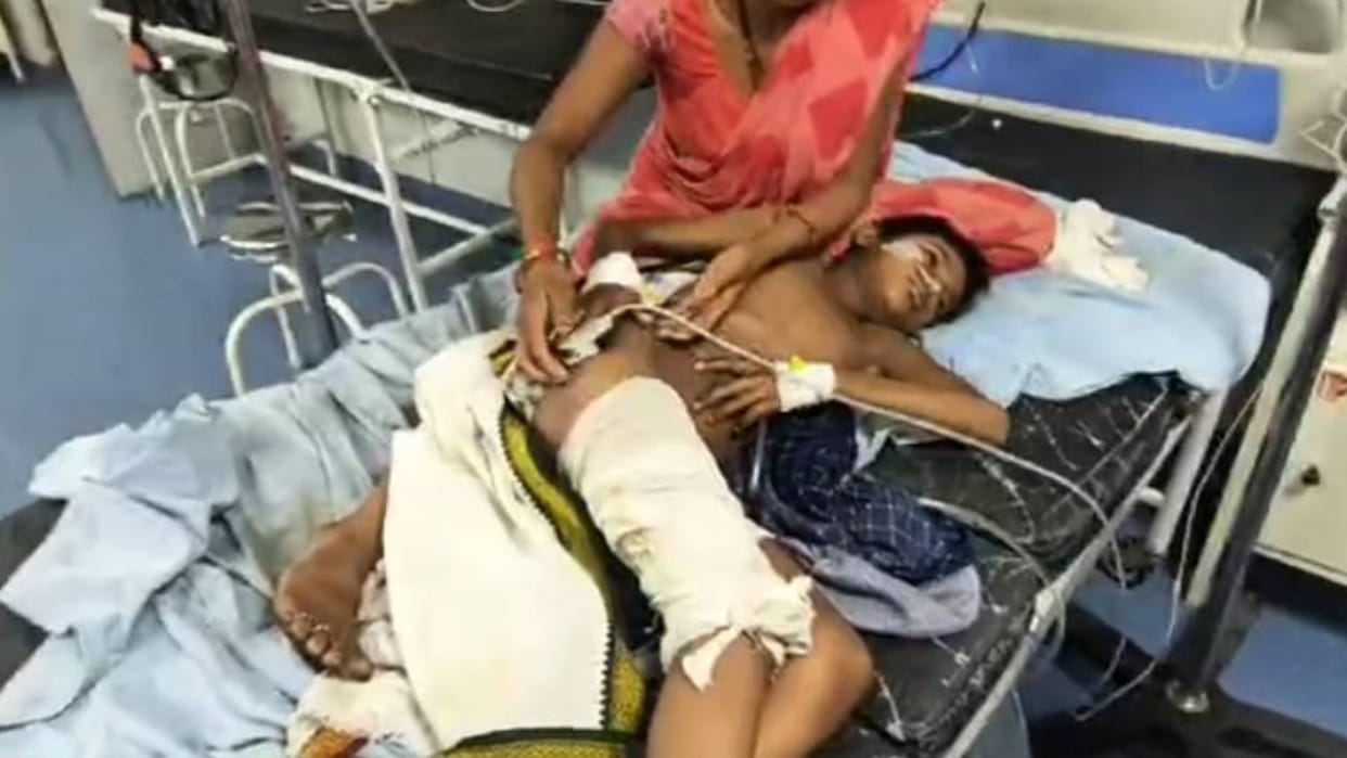 Lightning fell on a 10 year old boy playing outside the house