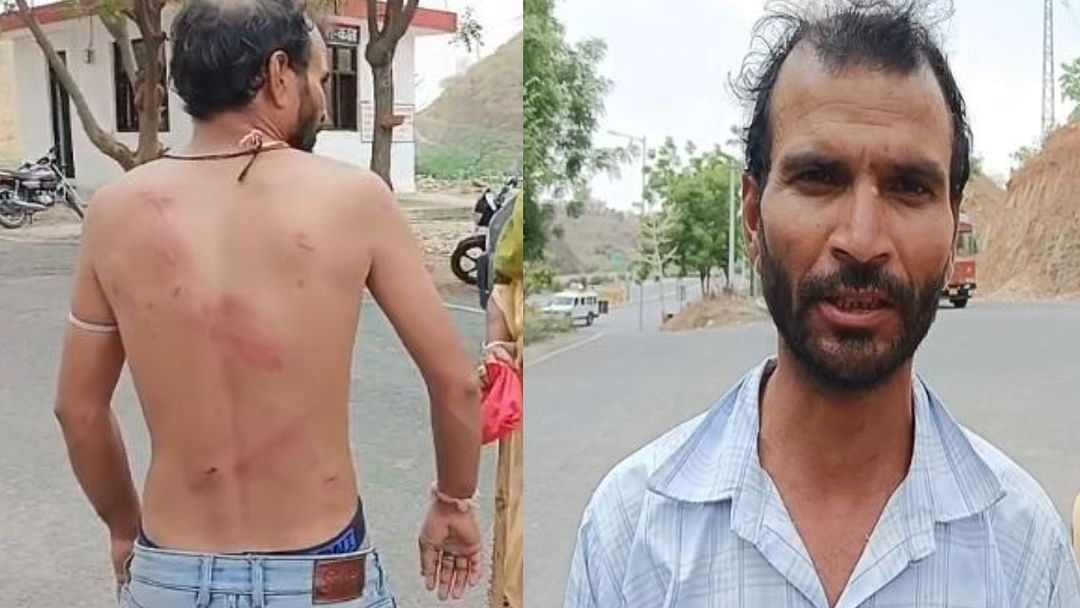 Udaipur News: Gave painful punishment for asking for two days leave, brutally beaten by brutal hotel owner