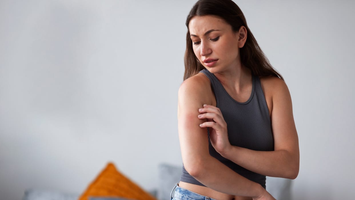 Simple Home remedies for Skin Heat Rash Try these natural methods Skincare tips in Hindi