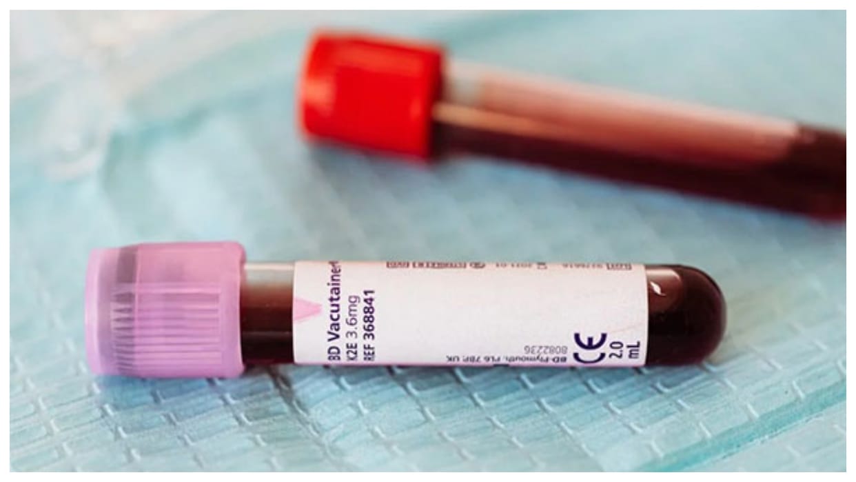 Britain infected blood scandal Investigation report will be published today