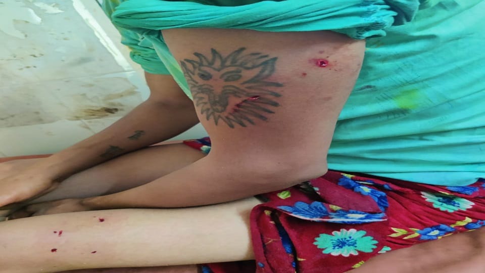पागल कुत्ते ने आठ लोगों को काटा