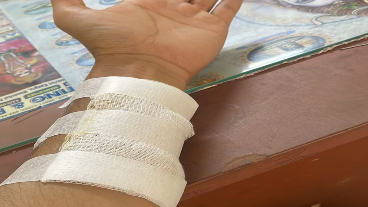 Two professors clash in CU one injured case registered in police