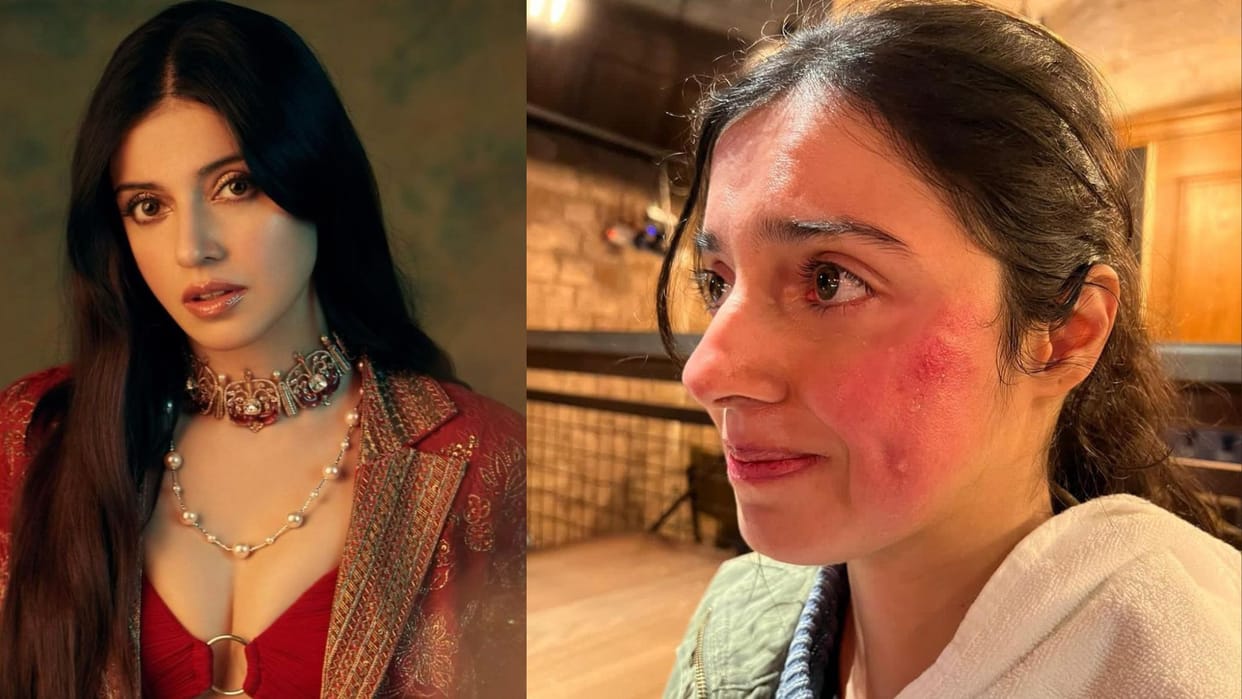 Divya Khossla Kumar injured during shoot of savi Was Howling and Crying when got injury on face
