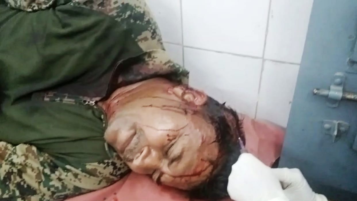 Crime: Police team which reached to arrest liquor smugglers in Gopalganj was attacked, one policeman injured