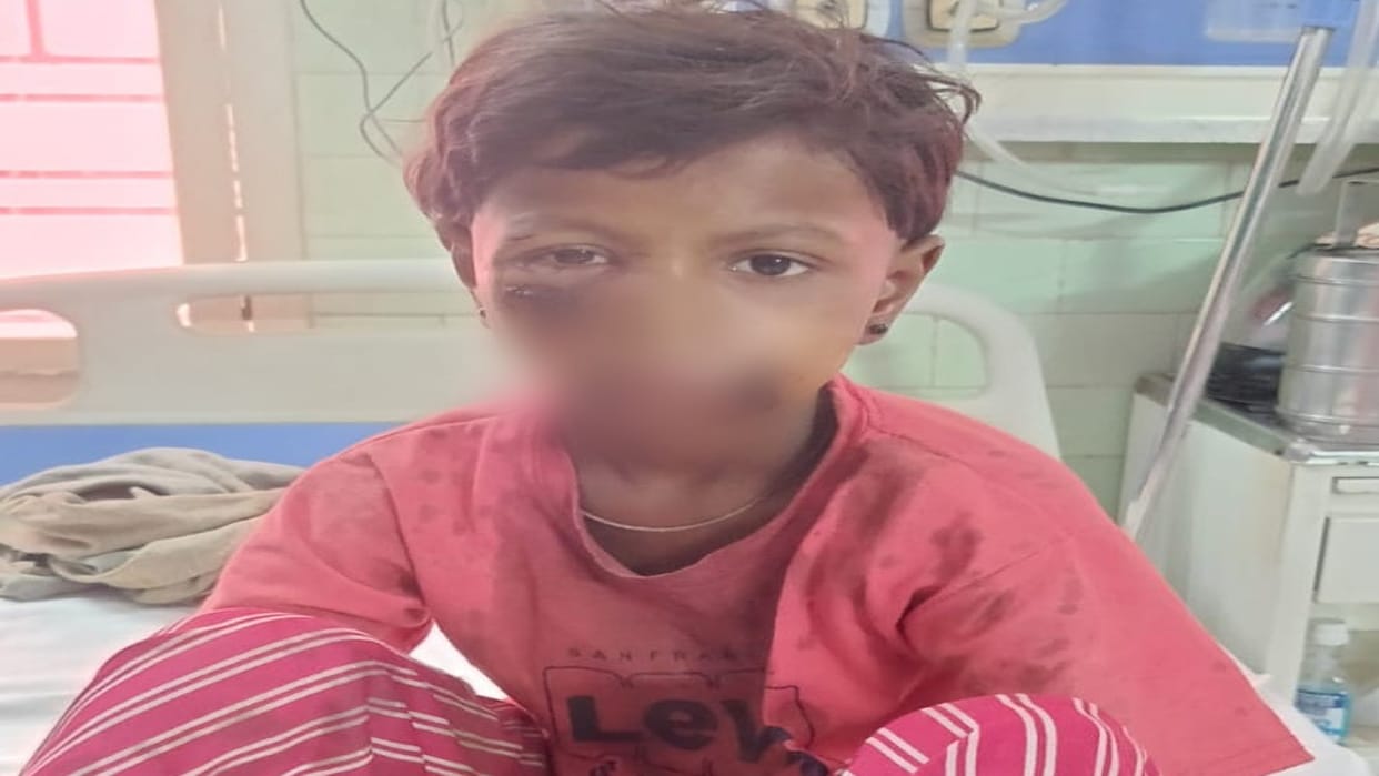 Jackal attacked 10 year old girl in Bareilly